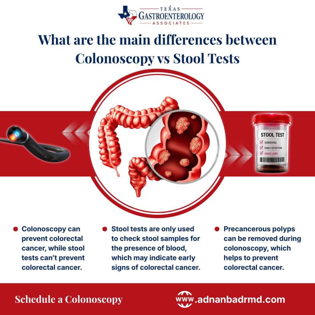 What are the main differences between Colonoscopy vs Stool Tests in Frisco/Plano, TX?