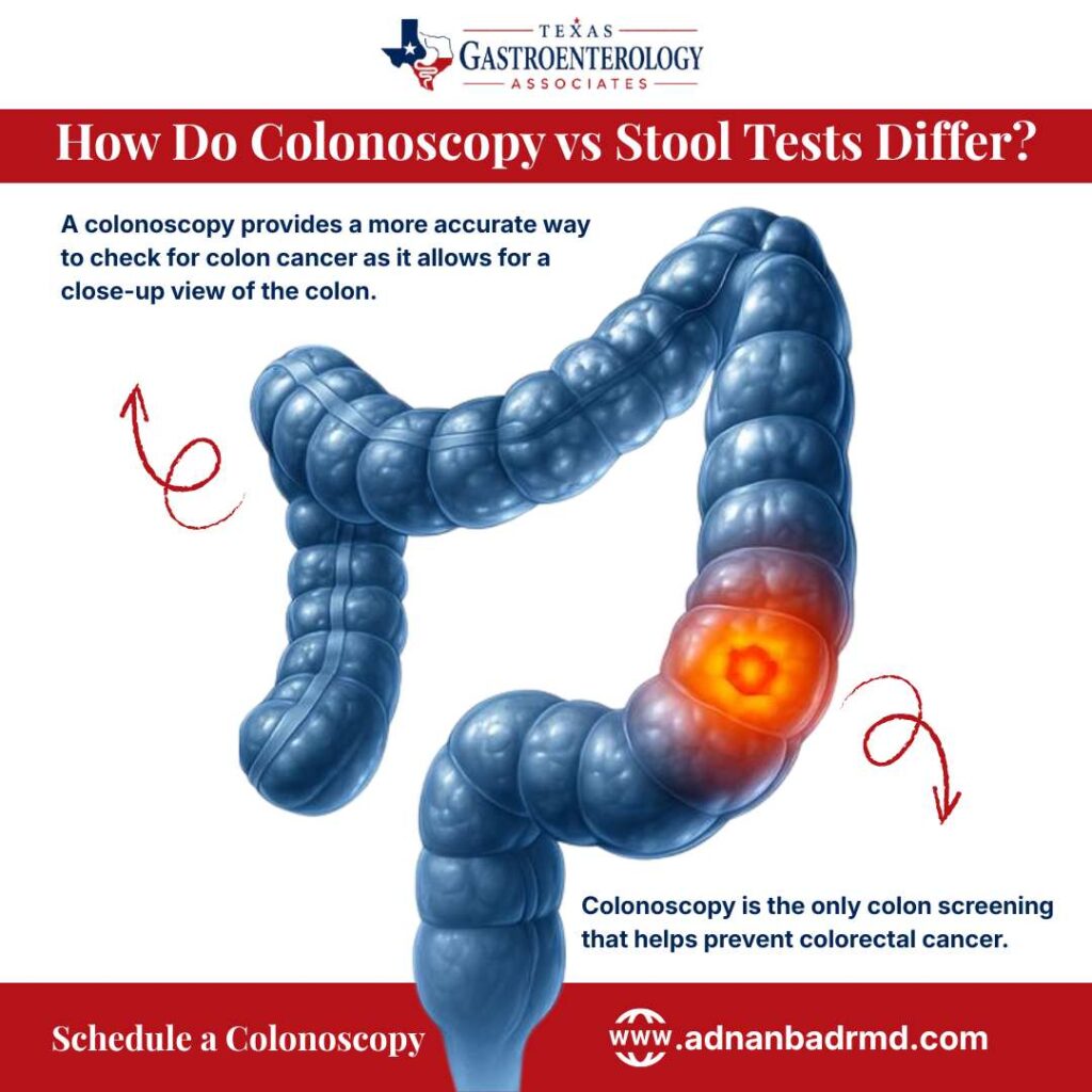 How Do Colonoscopy vs Stool Tests Differ?