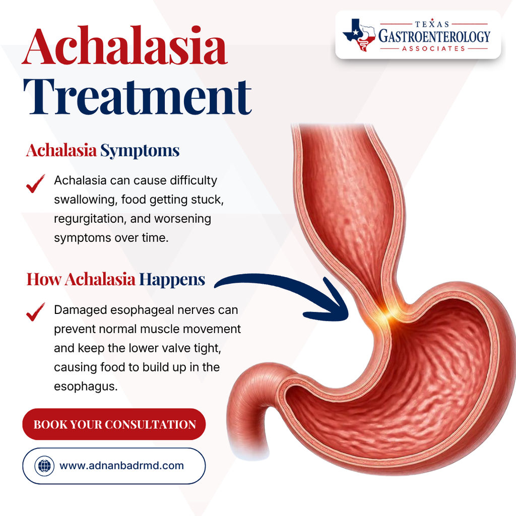 Achalasia Treatment in Frisco/Plano, TX