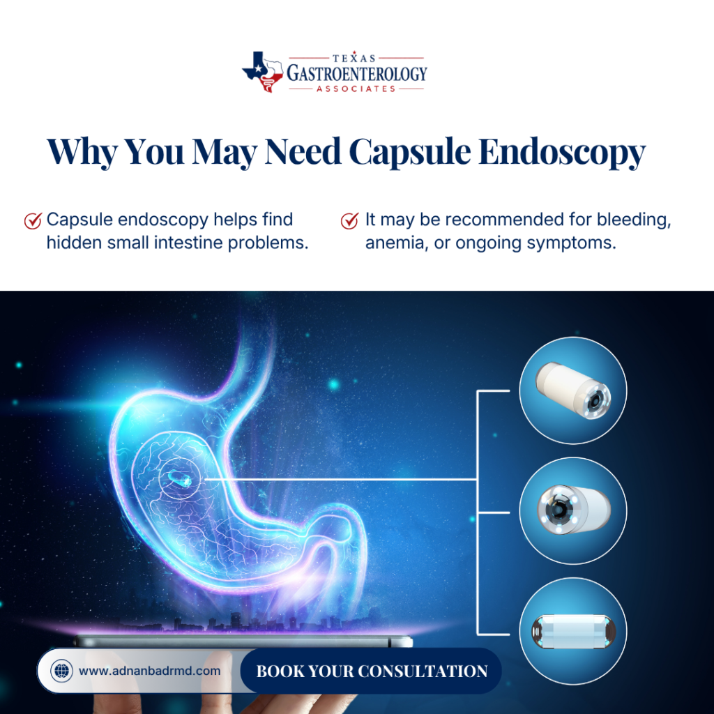 Why You May Need Capsule Endoscopy