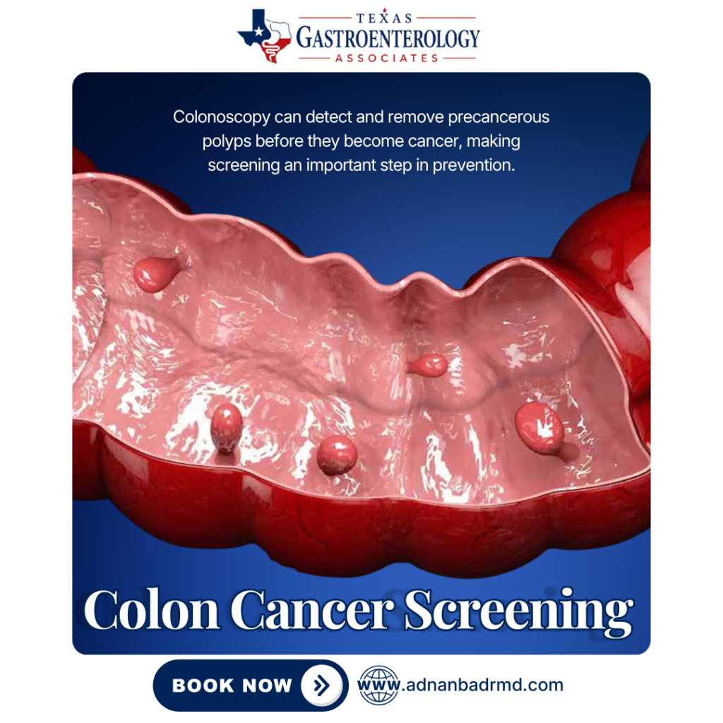 Colon Cancer Screening in Frisco/Plano, TX